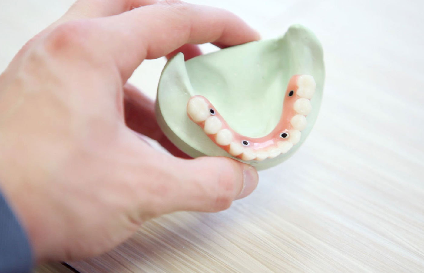 Why you should choose dental implants?